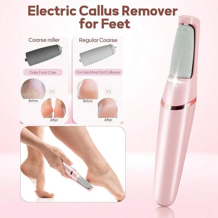 Electric Callus Remover For Feet | Rechargeable Foot File With 2 Roller Heads For Dry & Hard Skin